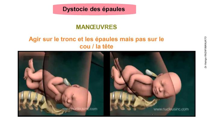 urgences-obstetricales_24.jpg